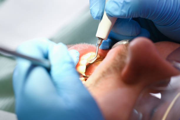 Best Emergency Broken Tooth Repair in Vinton, TX
