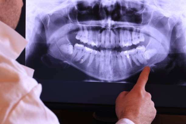 Best Emergency Broken Tooth Repair in Vinton, TX